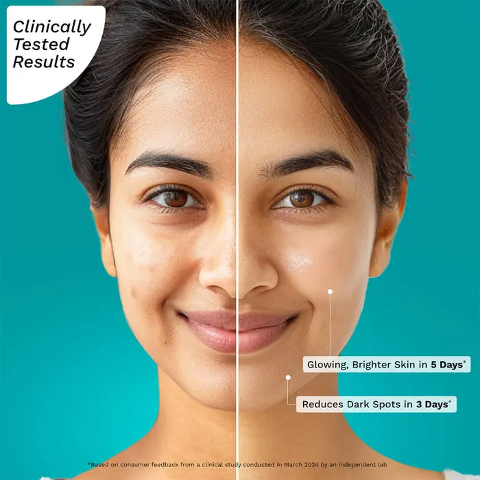 10_VitaminCFaceSerum_30ml_1080x1080_Before-After_908f35f4-048c-4282-888c-cfa55dd81767.webp