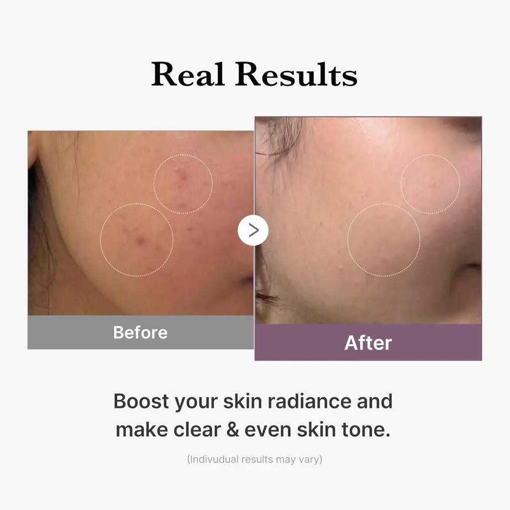 671a198919e1c74cb563f678-medicube-age-r-glutathione-glow-milky.webp